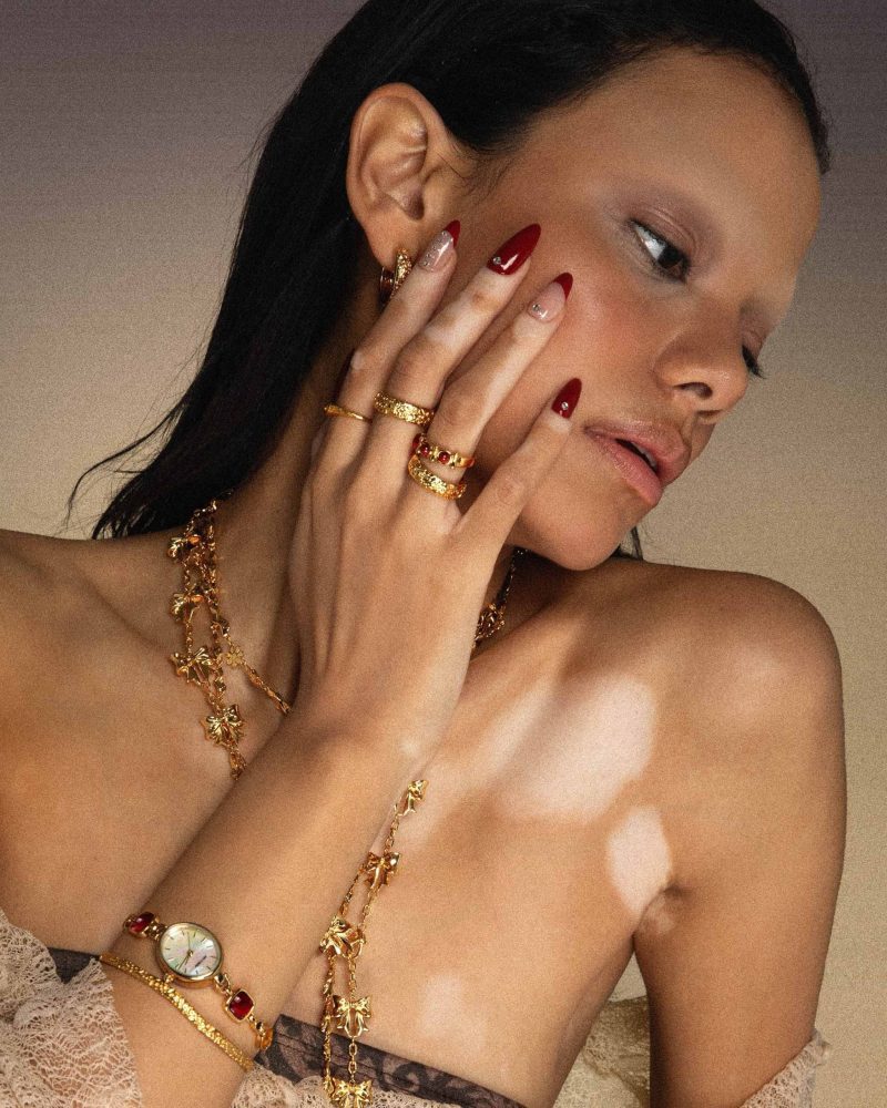 Serenade of Orchid Ring - 图片 4